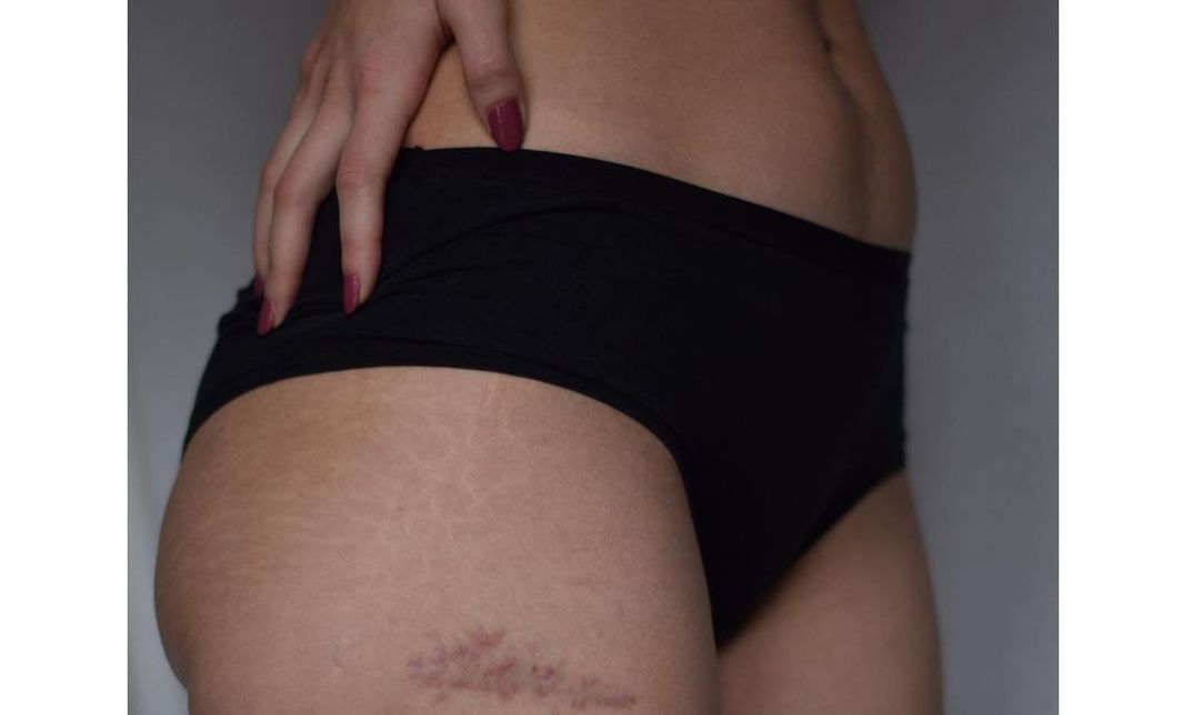 projekt prihvaćanja, self love