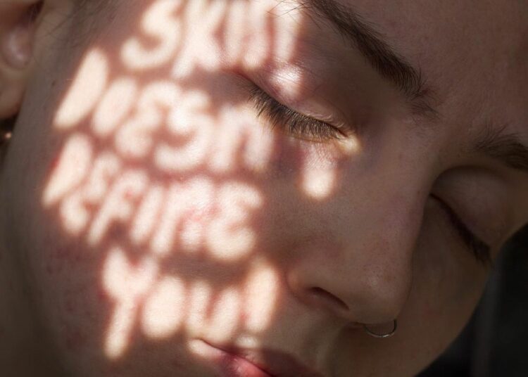 Your Skin Doesnt Define You natpis na licu