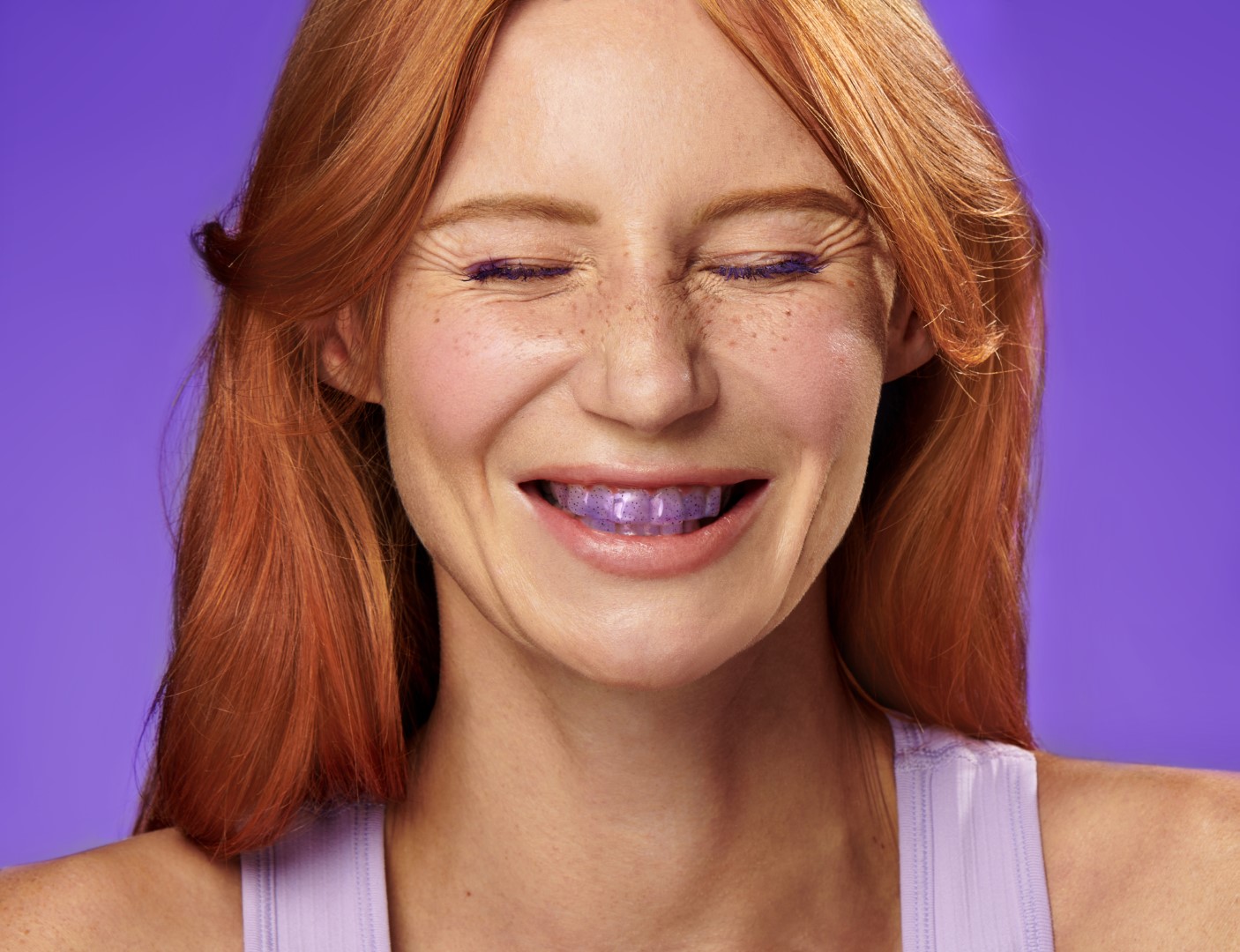 pasta za izbjeljivanje zuba