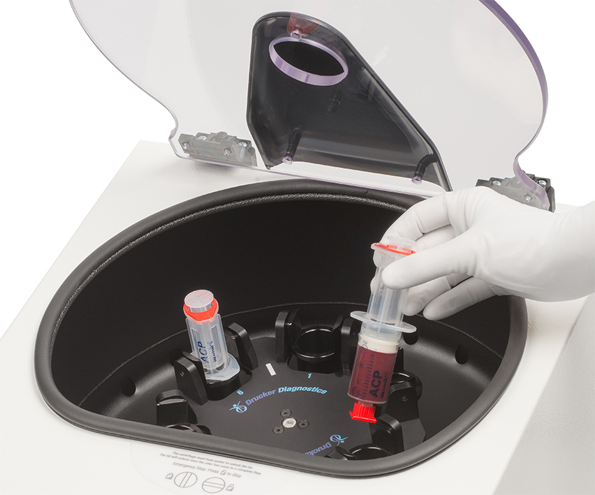 Regenerativna terapija