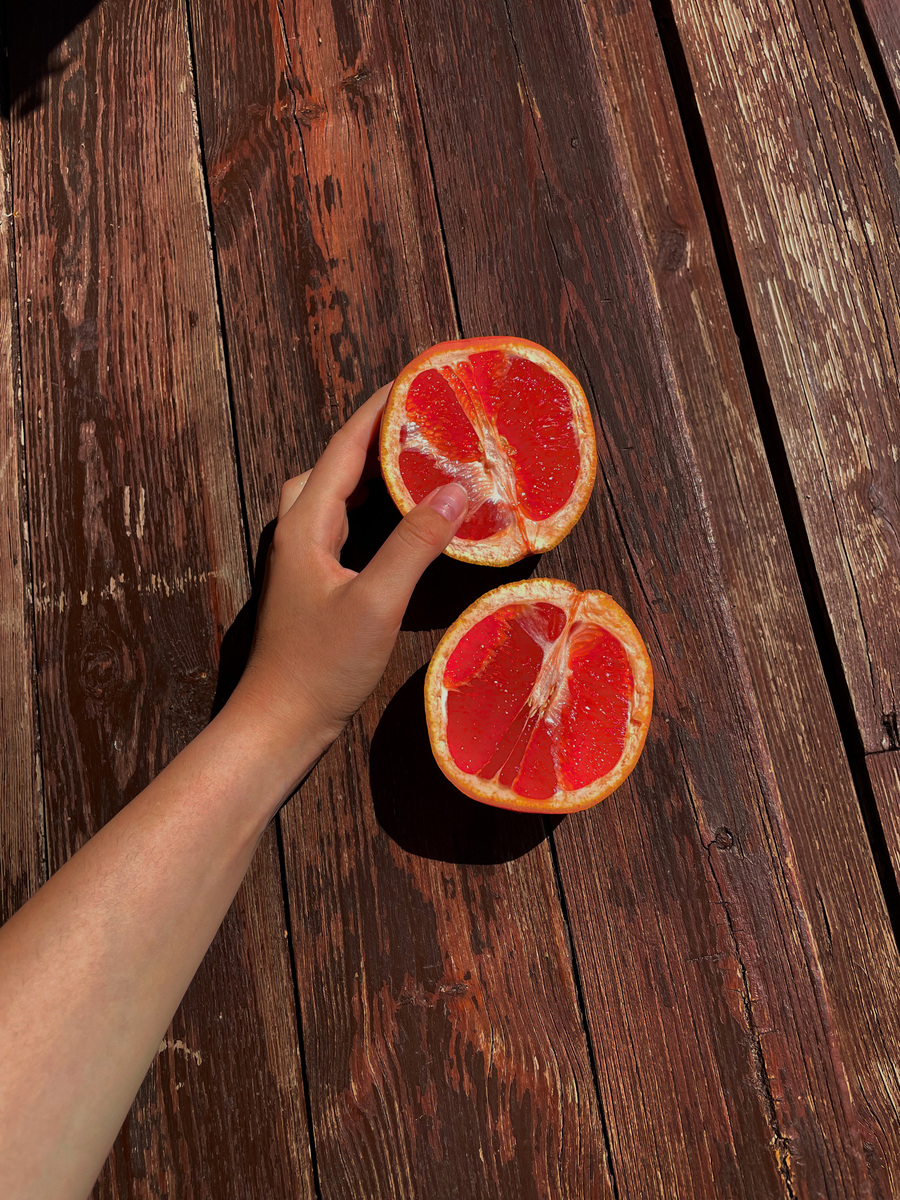 Zimske supernamirnice