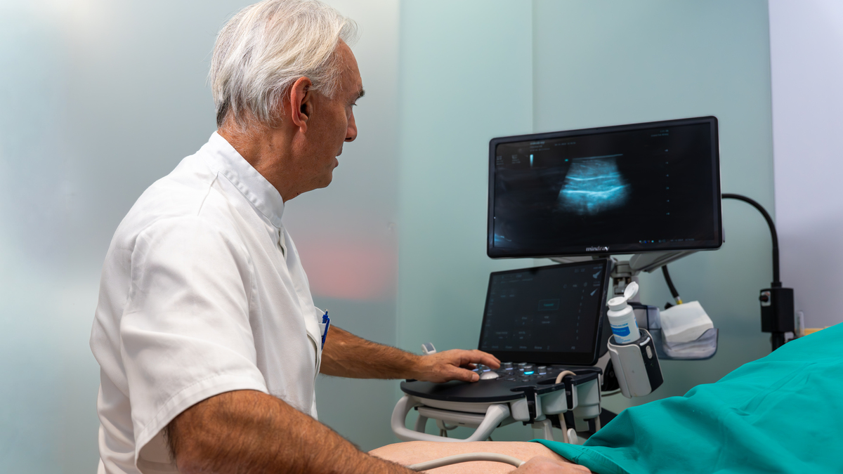 Proširene vene poliklinika Arithera