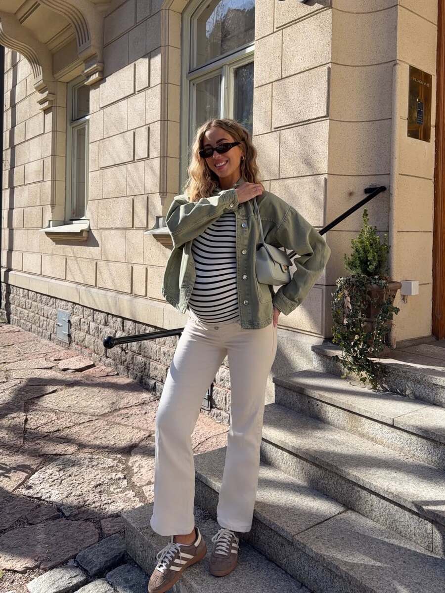 Dijastaza nakon poroda