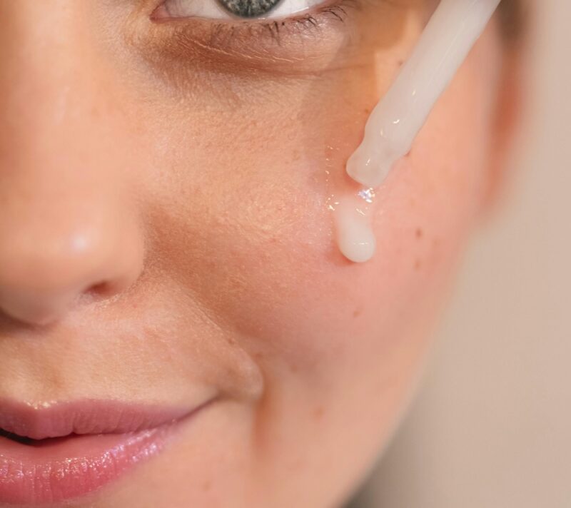 Izblijedite tamne mrljice sa serumima koje preporučuju dermatolozi