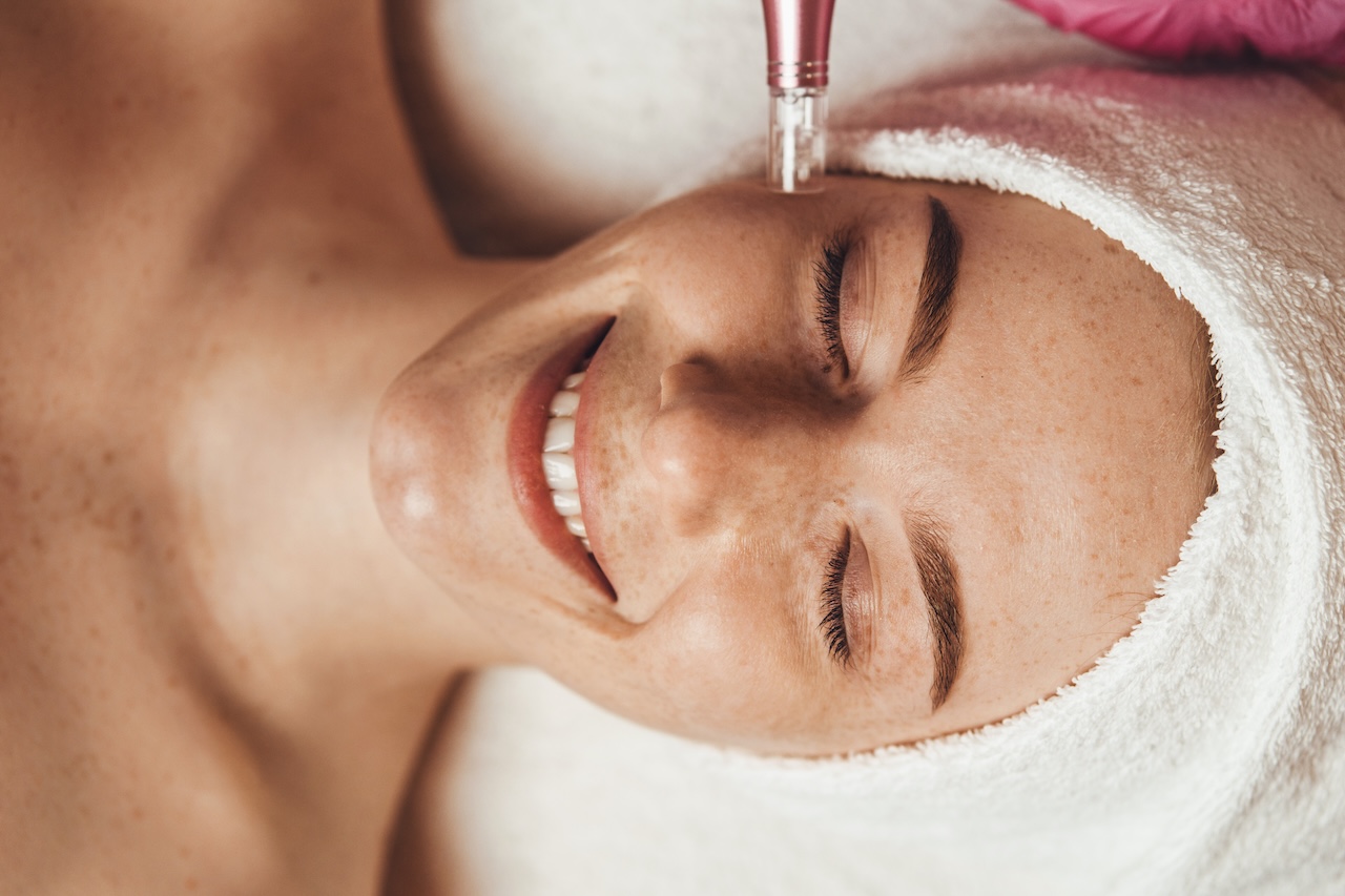bio microneedling