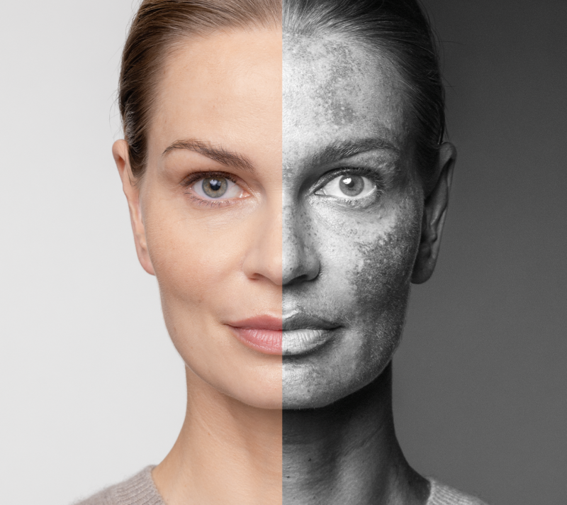 Kad ljeto ostavi trag na koži: Eucerin Anti-Pigment rutina za ujednačeniji ten