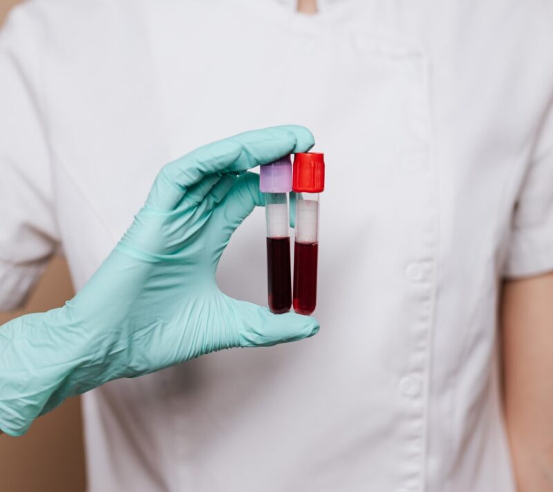 menstrualna krv u medicini